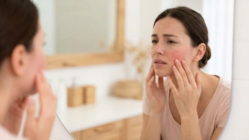 Woman gently massaging sore cheeks after a buccal massage spa treatment